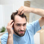 Is Finasteride an Effective Solution for Hair Loss?